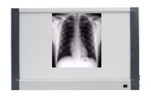 X-Ray viewing box